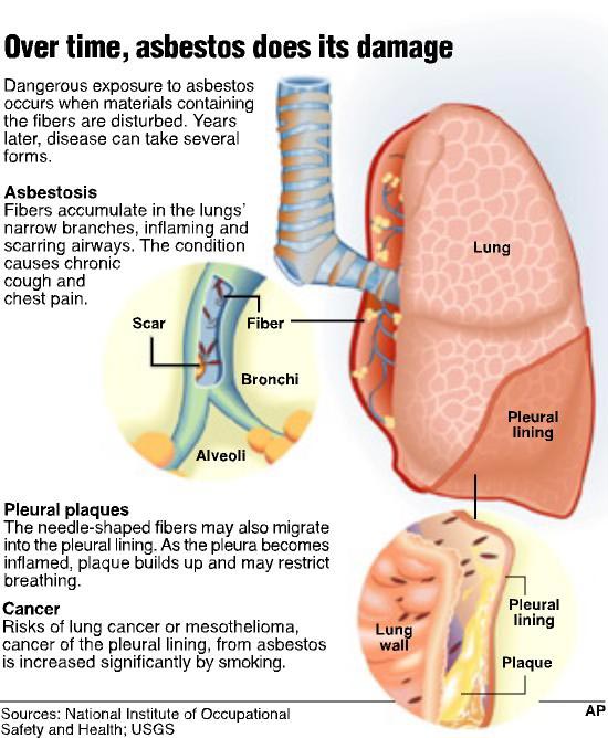 Lung Damage